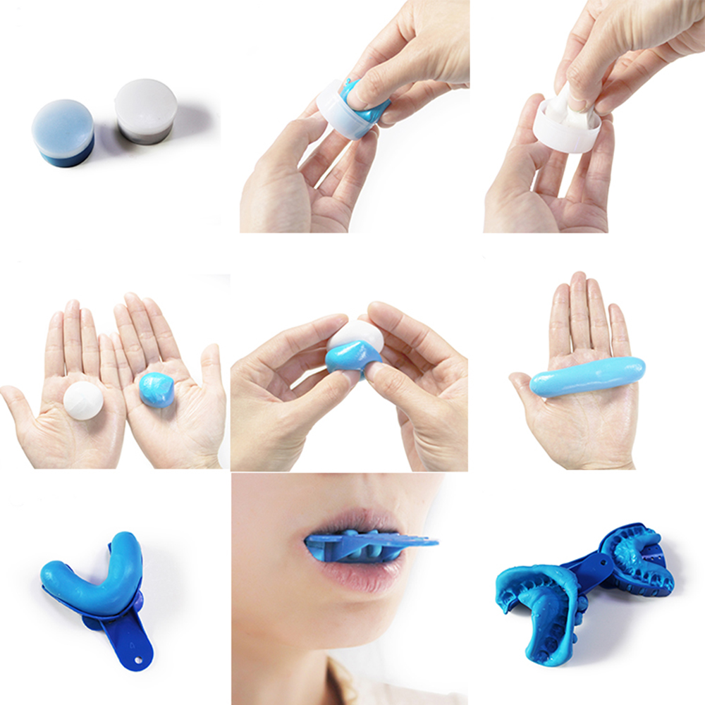 Dental Impression Material Kit - Luxsmile Nha Khoa Lâm Sàng Ấn