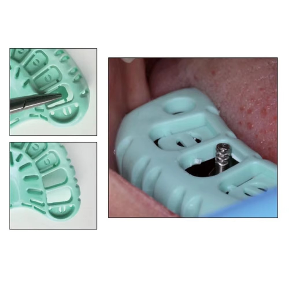 FULAIGE 6Pcs/Set Disposable De - đánh giá và giá Dental Impression Material Kit