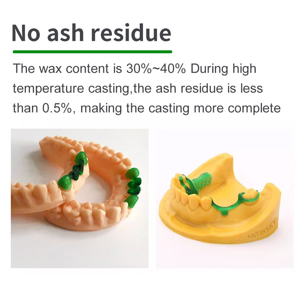 Antinsky Castable Dental Smart - đánh giá và giá Dental 3D Printer Resin