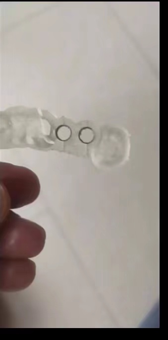 Resin Dental 3D Printer Planti - đánh giá và giá Dental 3D Printer Resin