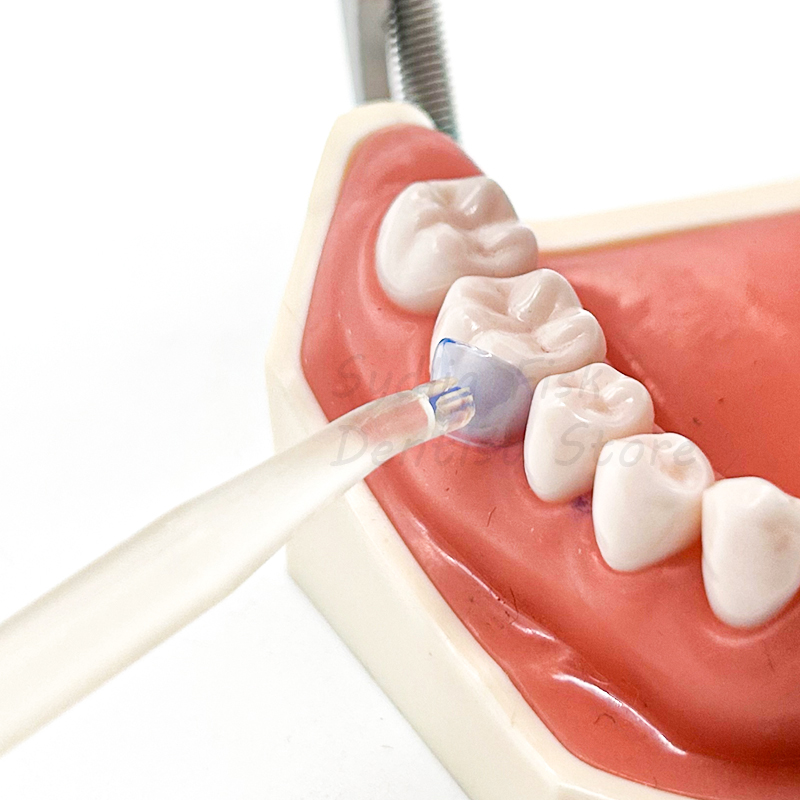 100 Cái/Bộ Ma Trận Nha Khoa Tr - đánh giá và giá Dental Impression Material Kit