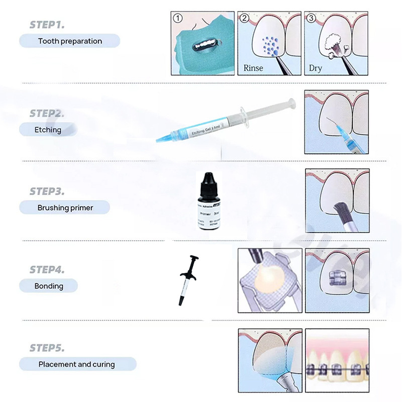Dental Light Curing Orthodonti - đánh giá và giá Dental Impression Material Kit